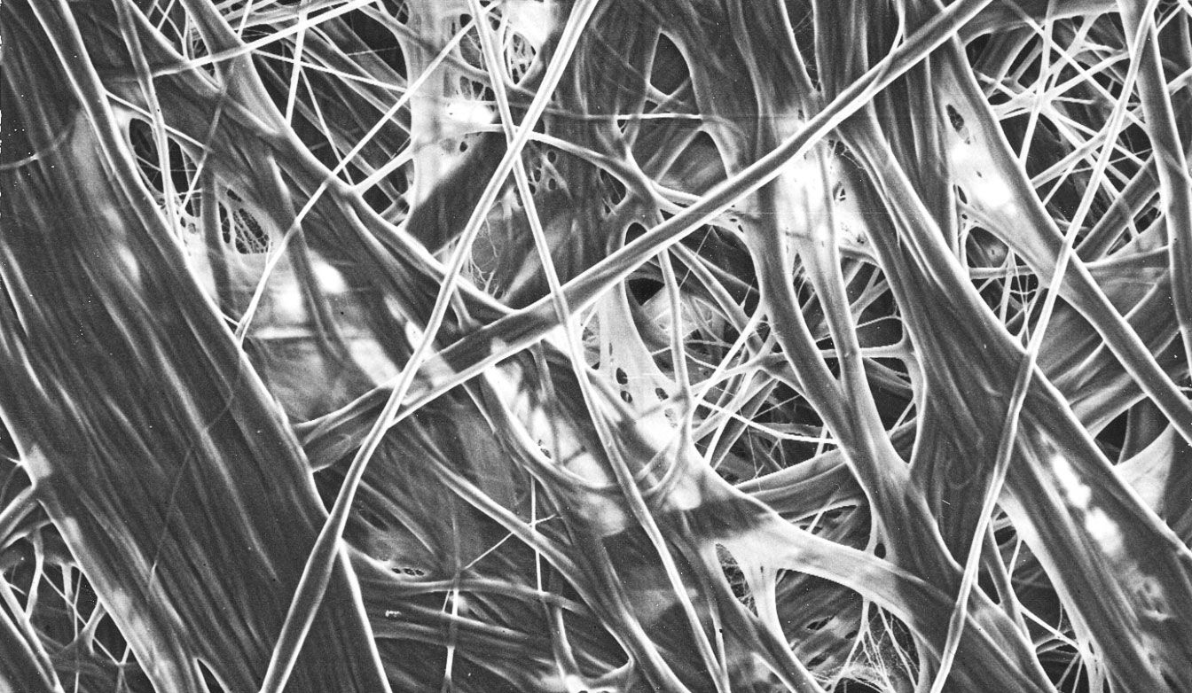 The structure of Tyvek® at the microscopic level