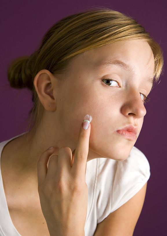 Woman using spot treatment for acne.